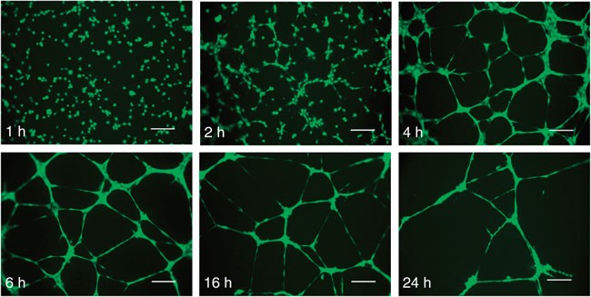 Human Umbilical Vein Endothelial Cells (HUVEC)