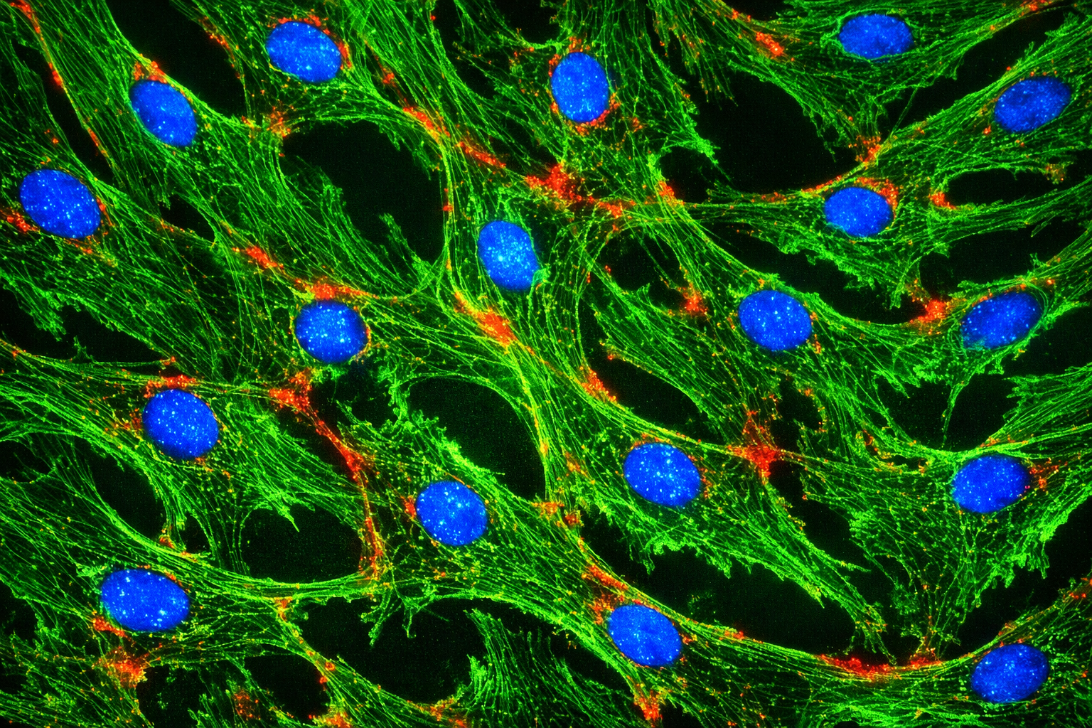 Human Dermal Microvascular Cancer-Associated  Endothelial Cells