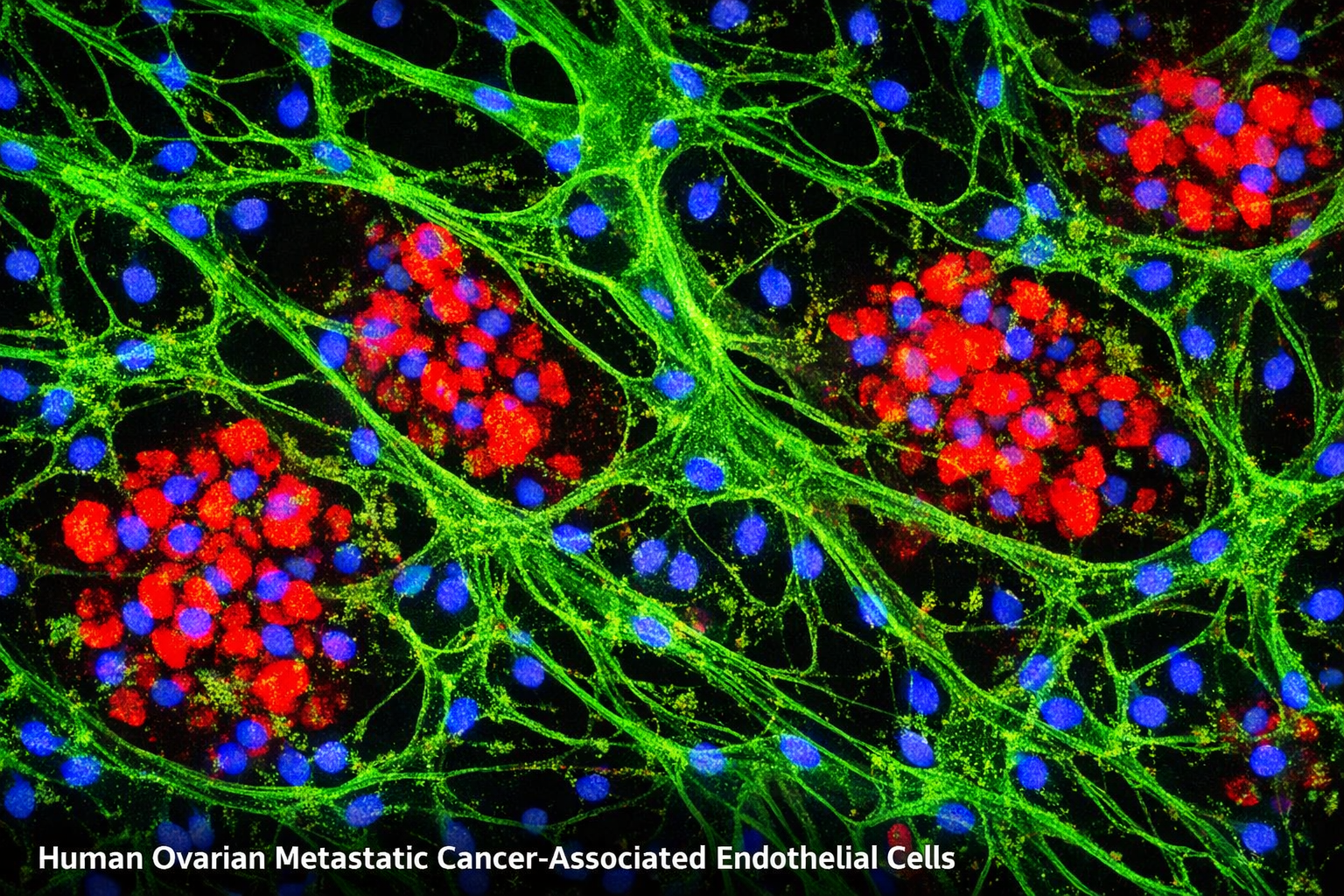 Human Ovarian Metastatic Cancer-Associated  Endothelial Cells