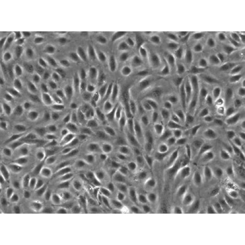 Human Diabetic Primary Artery Endothelial Cells ( Coronary)