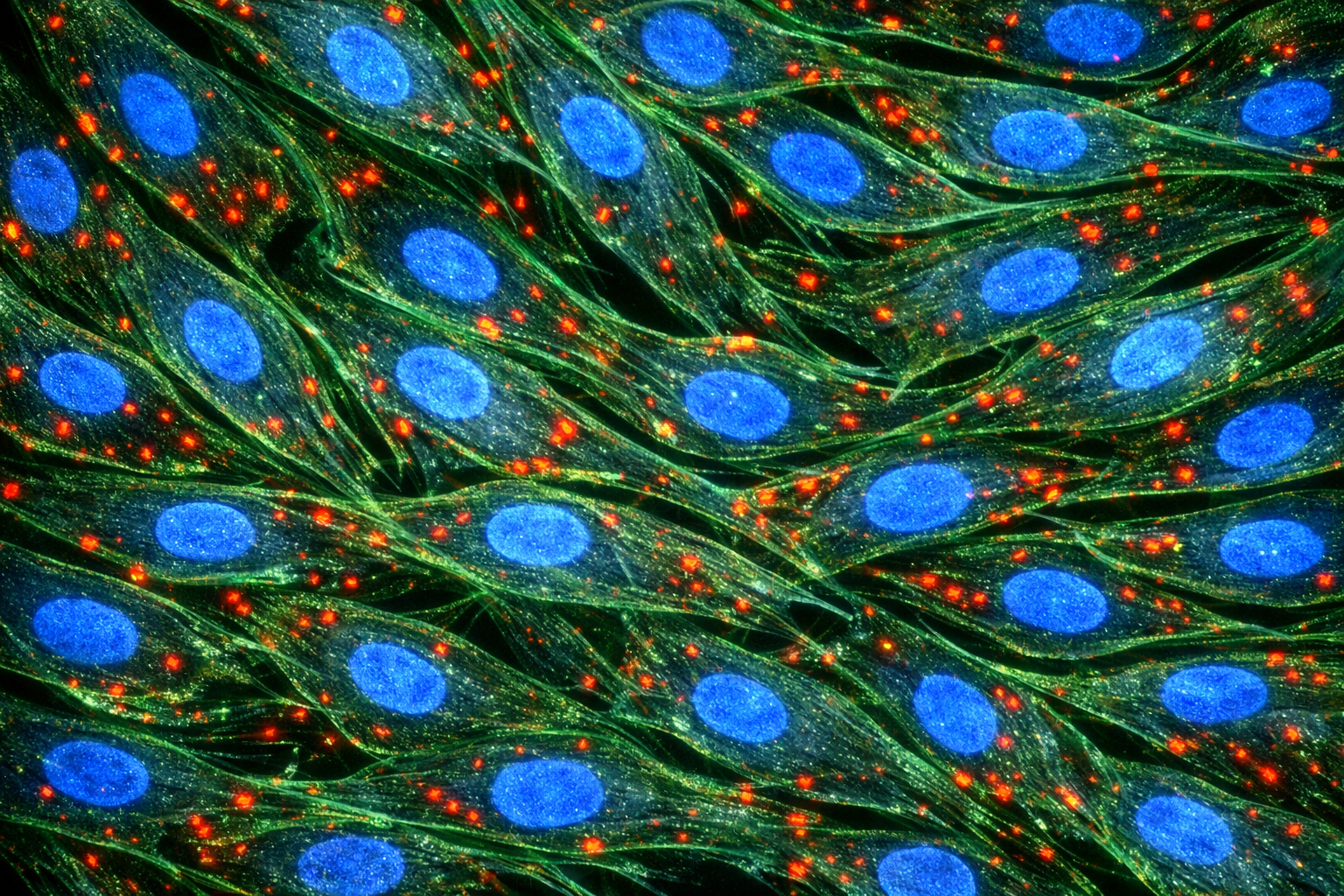 Human Primary Diabetic Kidney Endothelial Cells