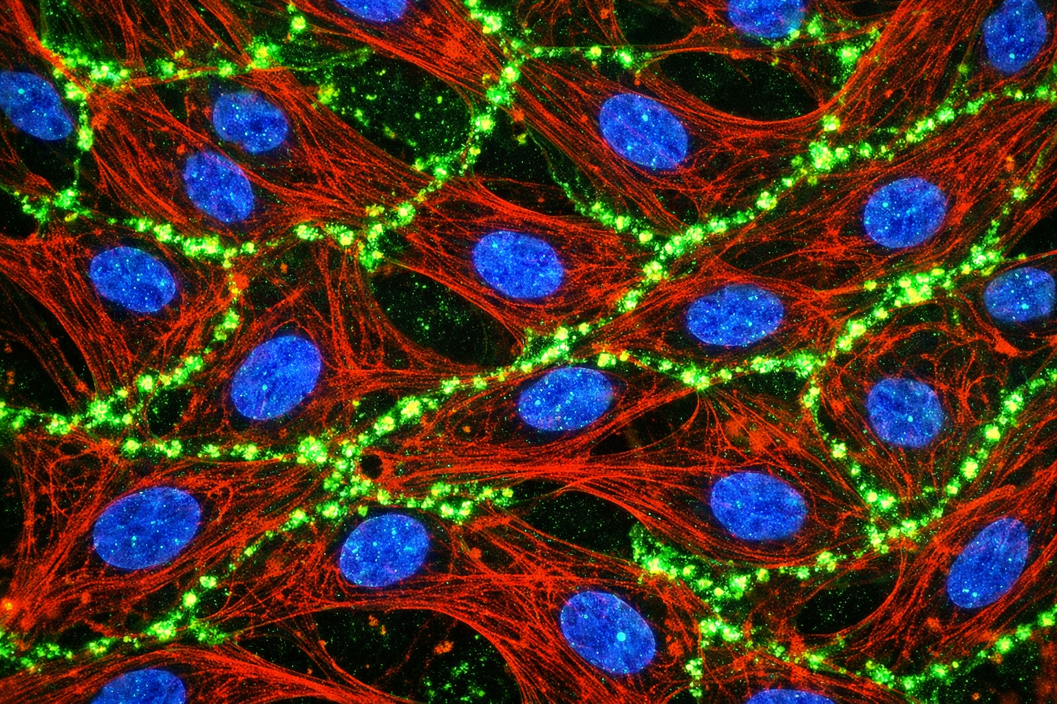 Human Primary Diabetic Kidney Vein Endothelial Cells