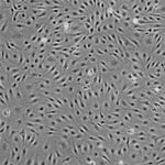 Human Primary Diabetic Liver Endothelial Cells