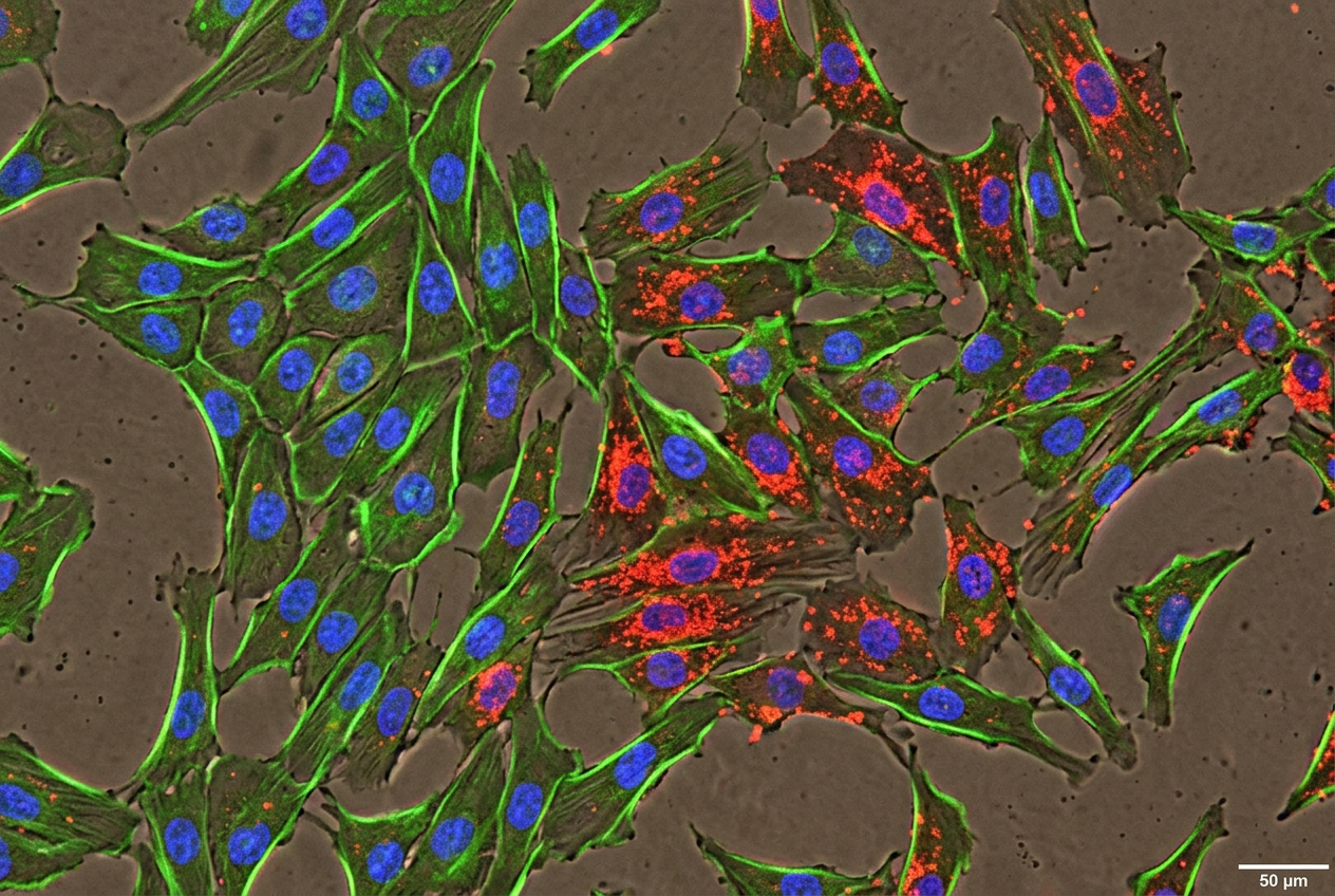 Human Primary Diabetic Liver Vein Endothelial Cells