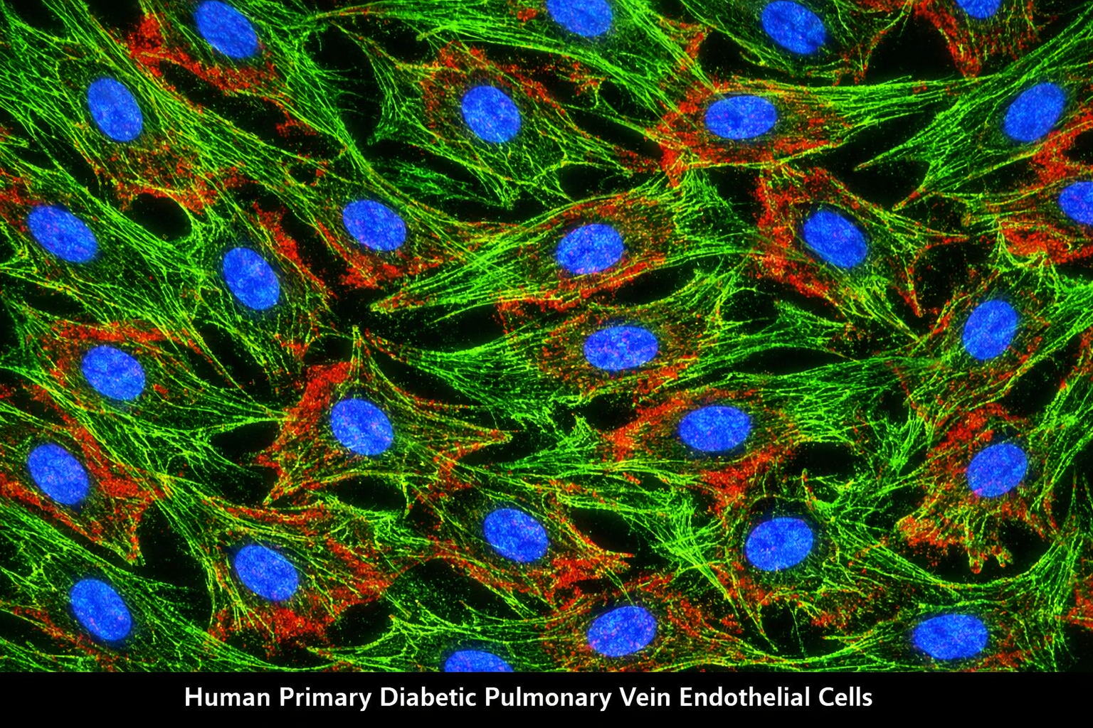 Human Primary Diabetic Pulmonary Vein Endothelial Cells