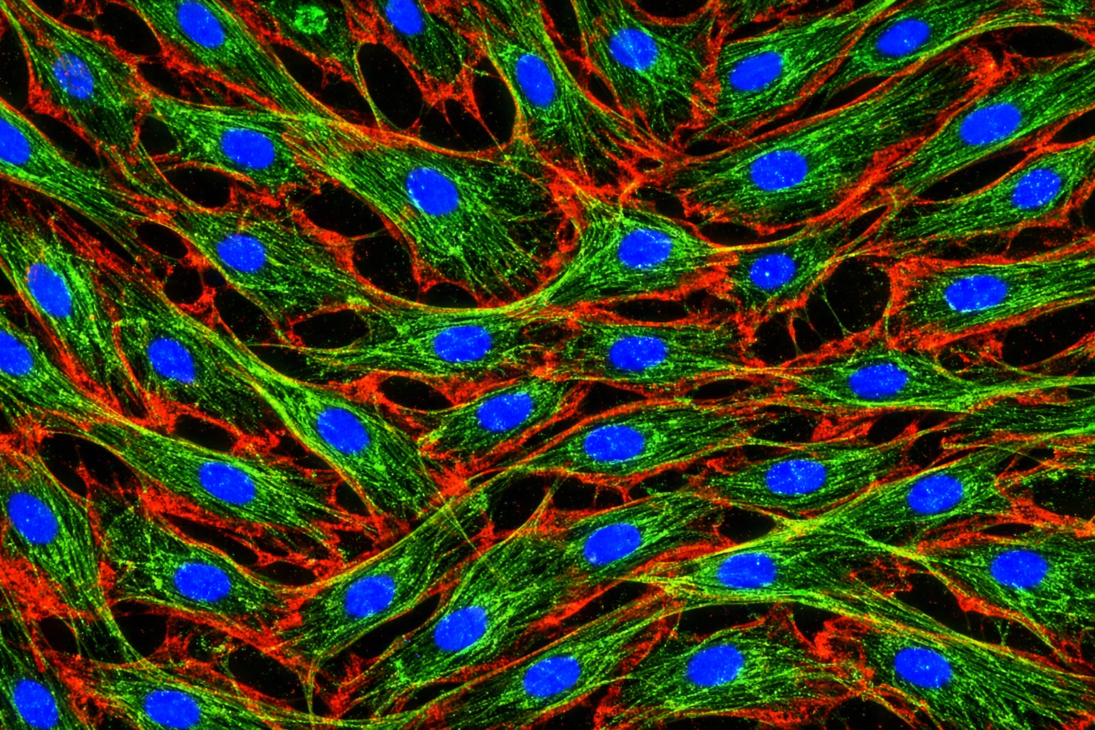 Human Primary Diabetic Vein Endothelial Cells
