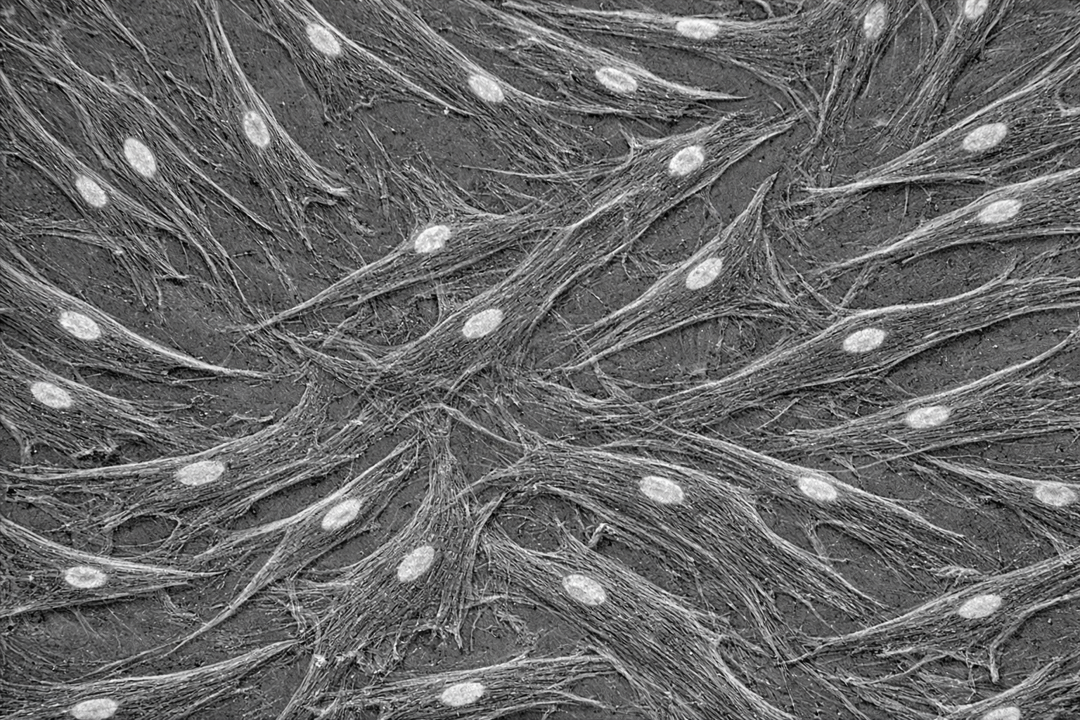 Human Diabetic Primary Aortic Fibroblast Cells