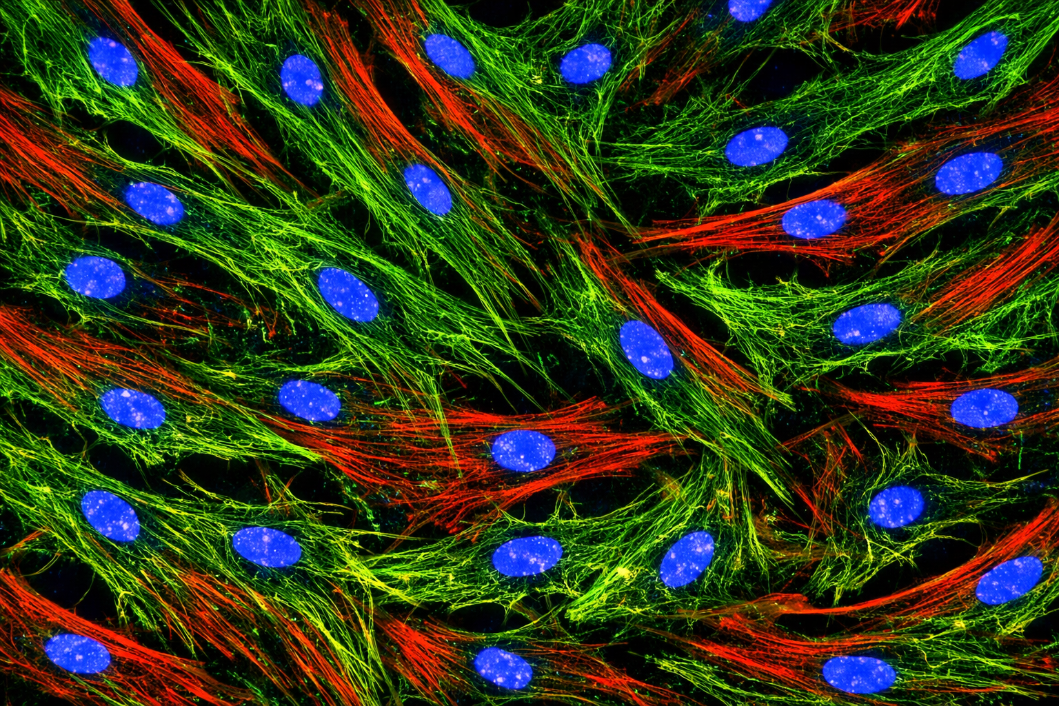 Human Diabetic Primary Artery Fibroblast Cells