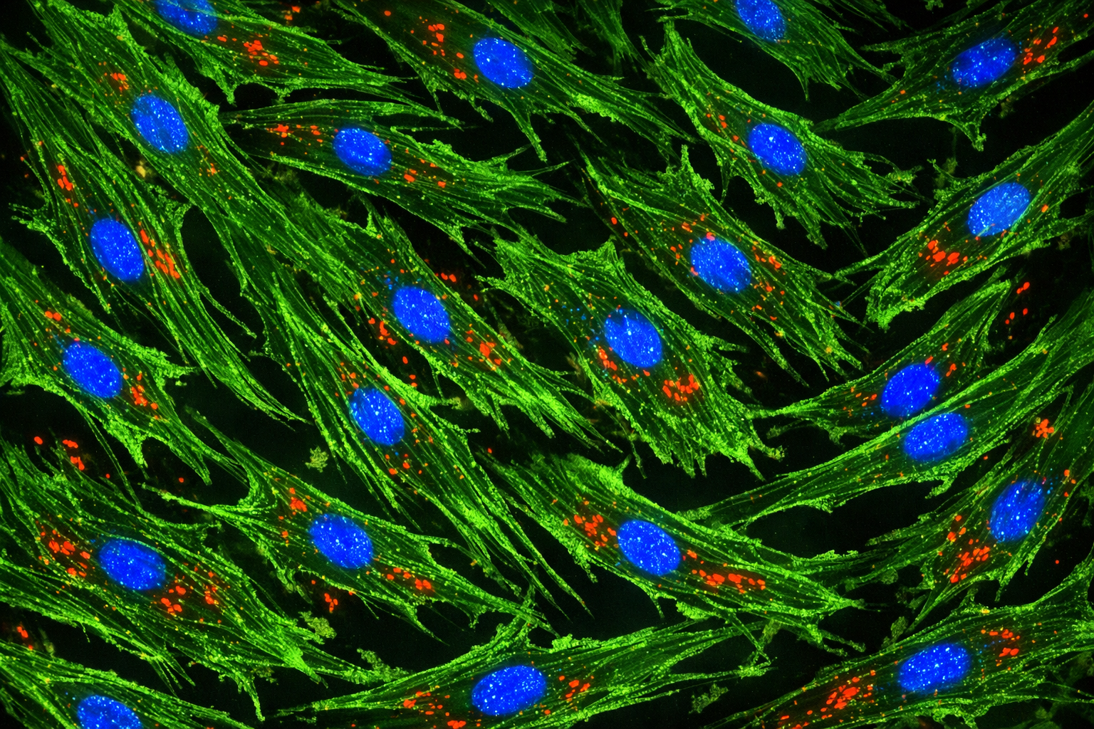Human Diabetic Primary Cardiac Fibroblast Cells
