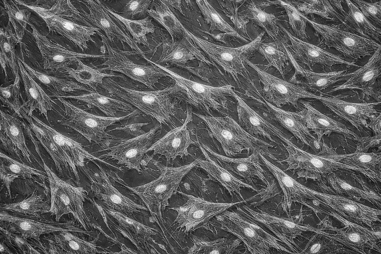 Human Diabetic Primary Dermal Fibroblast Cells