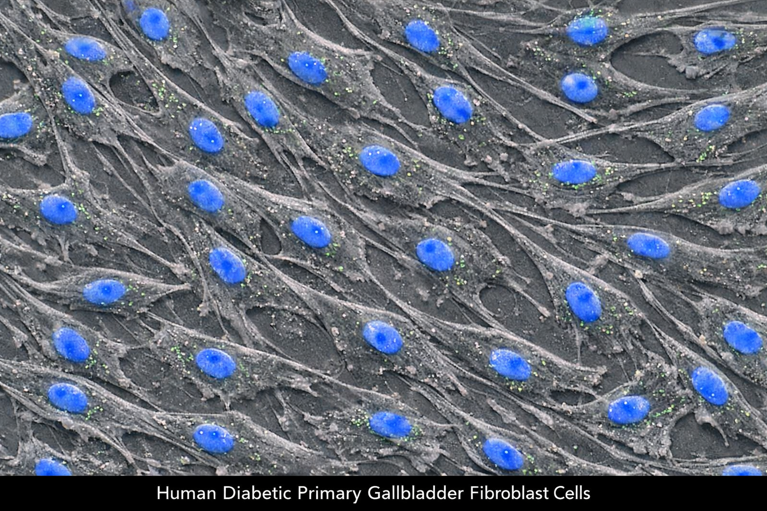 Human Diabetic Primary Gallbladder Fibroblast Cells
