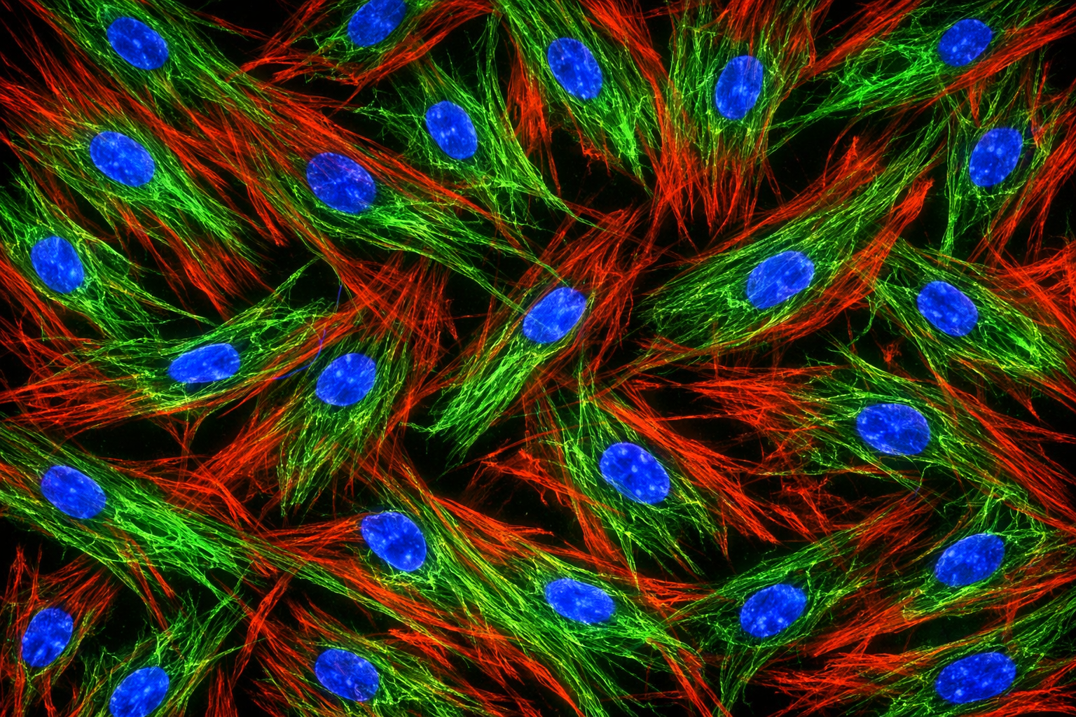 Human Diabetic Primary Kidney Fibroblast Cells
