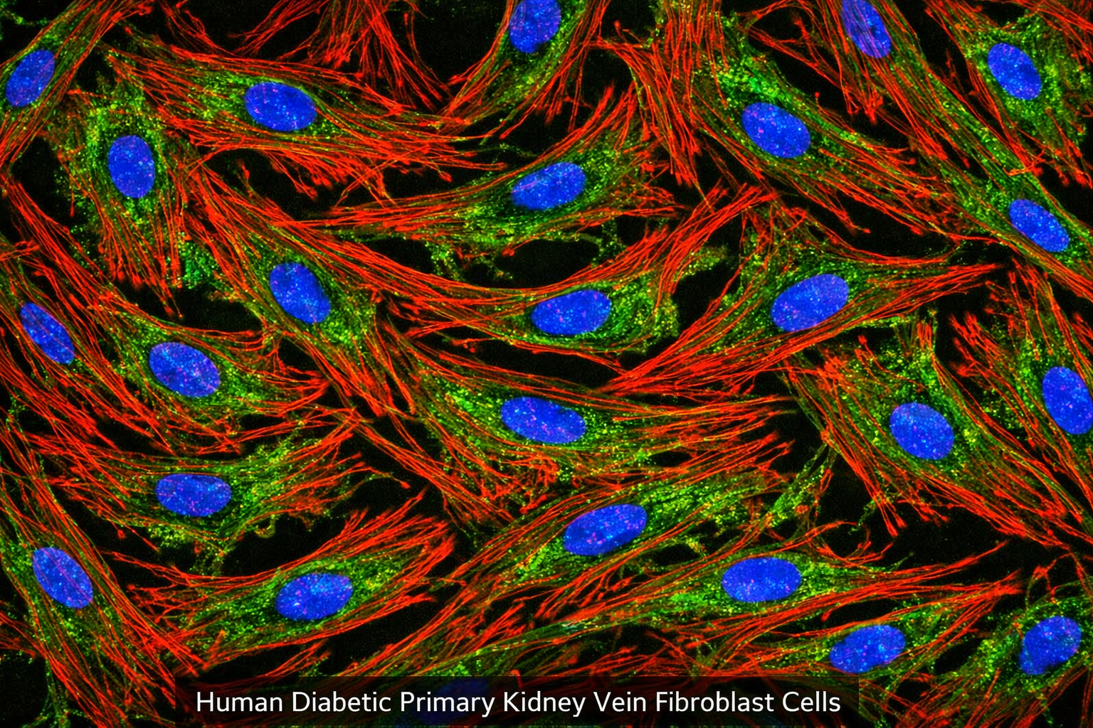 Human Diabetic Primary Kidney Vein Fibroblast Cells