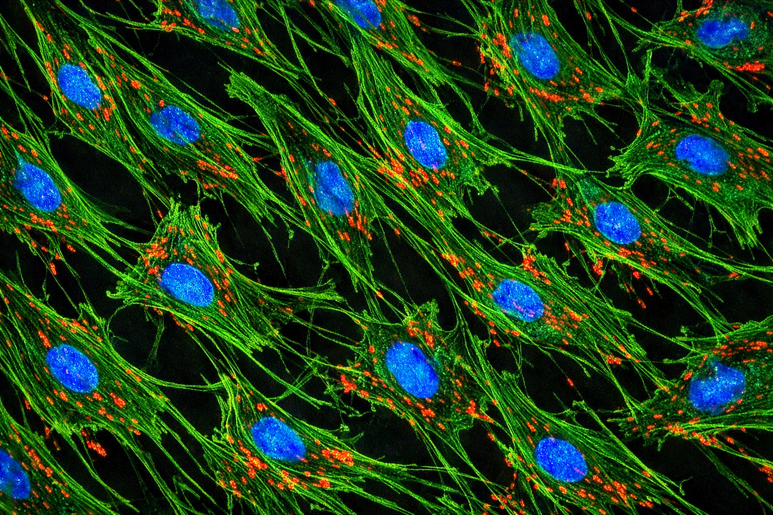 Human Diabetic Primary Pulmonary Fibroblast Cells