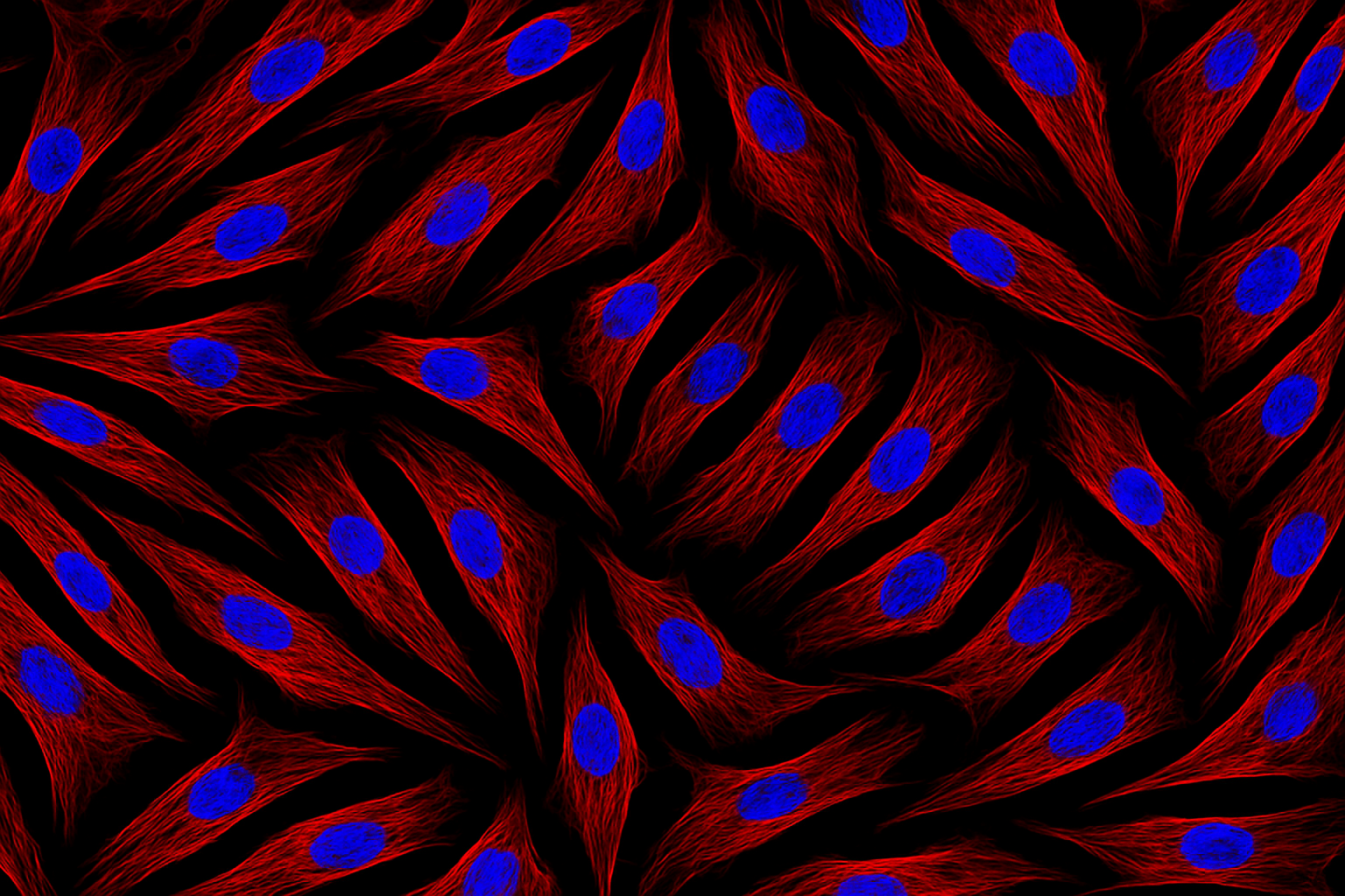 Human Diabetic Primary Pulmonary Vein Fibroblast Cells