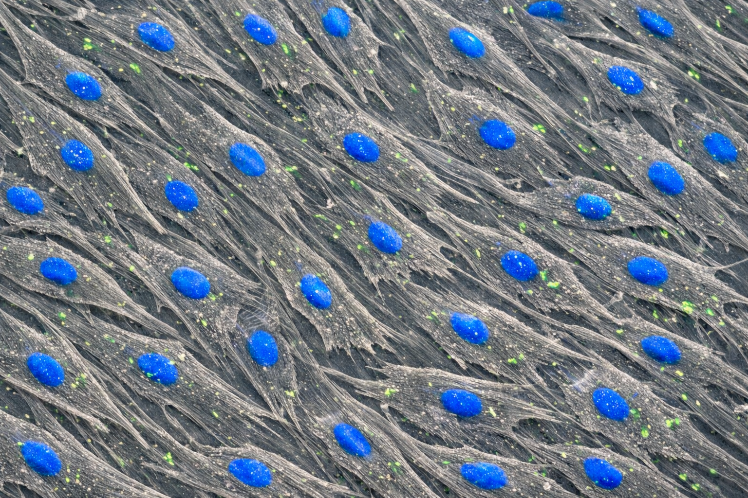 Human Primary Diabetic Aortic Smooth Muscle Cells