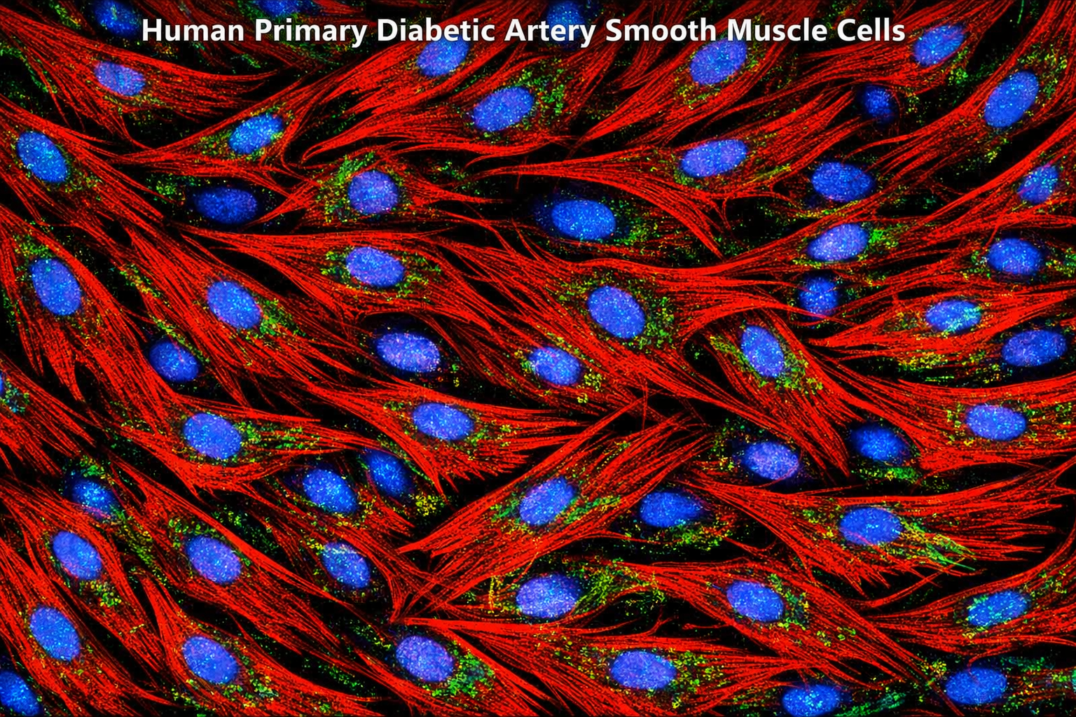 Human Primary Diabetic Artery Smooth Muscle Cells