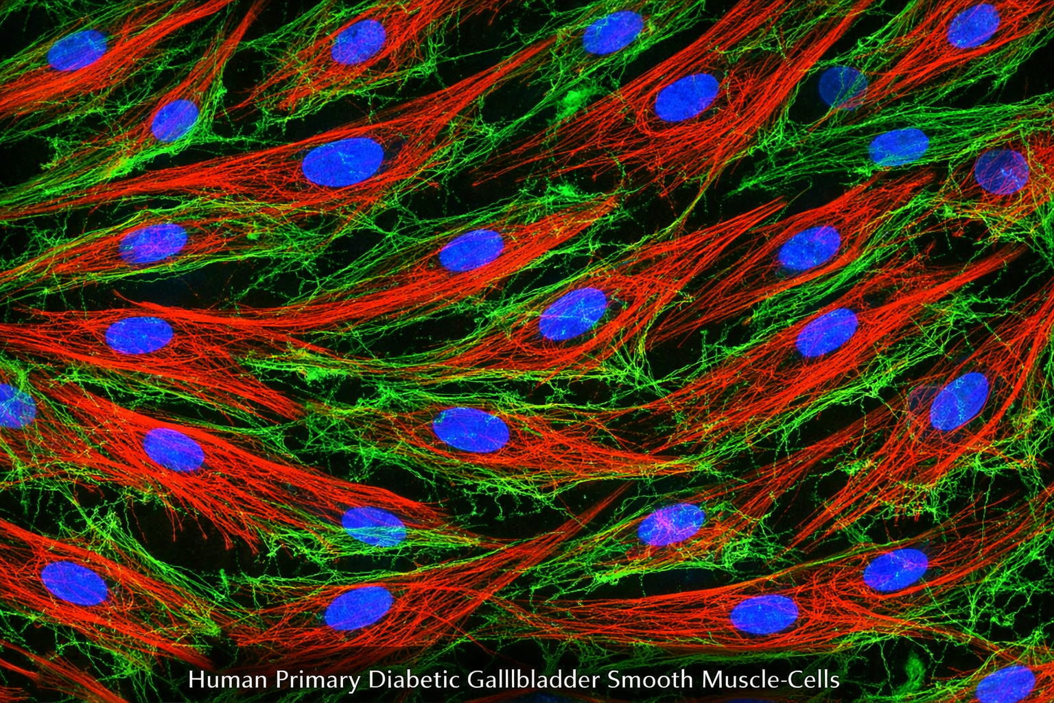 Human Primary Diabetic Gallbladder Smooth Muscle Cells