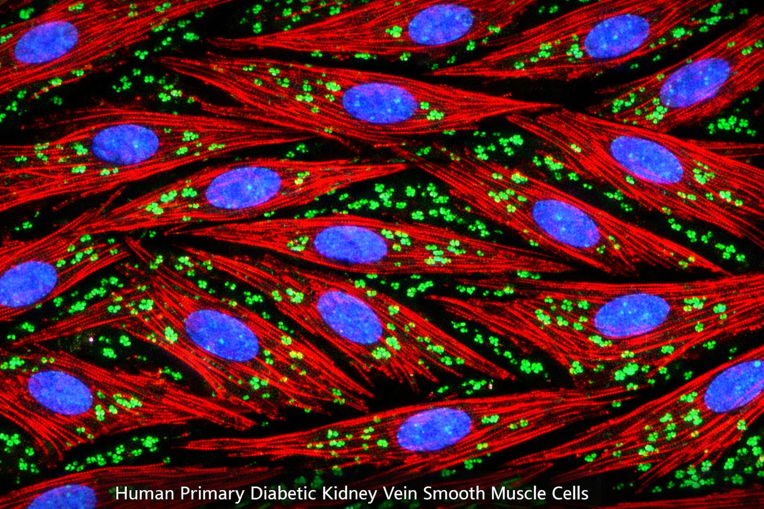 Human Primary Diabetic Kidney Vein Smooth Muscle Cells