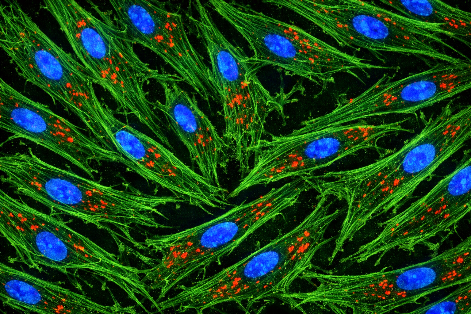 Human Primary Diabetic Liver Artery Smooth Muscle Cells