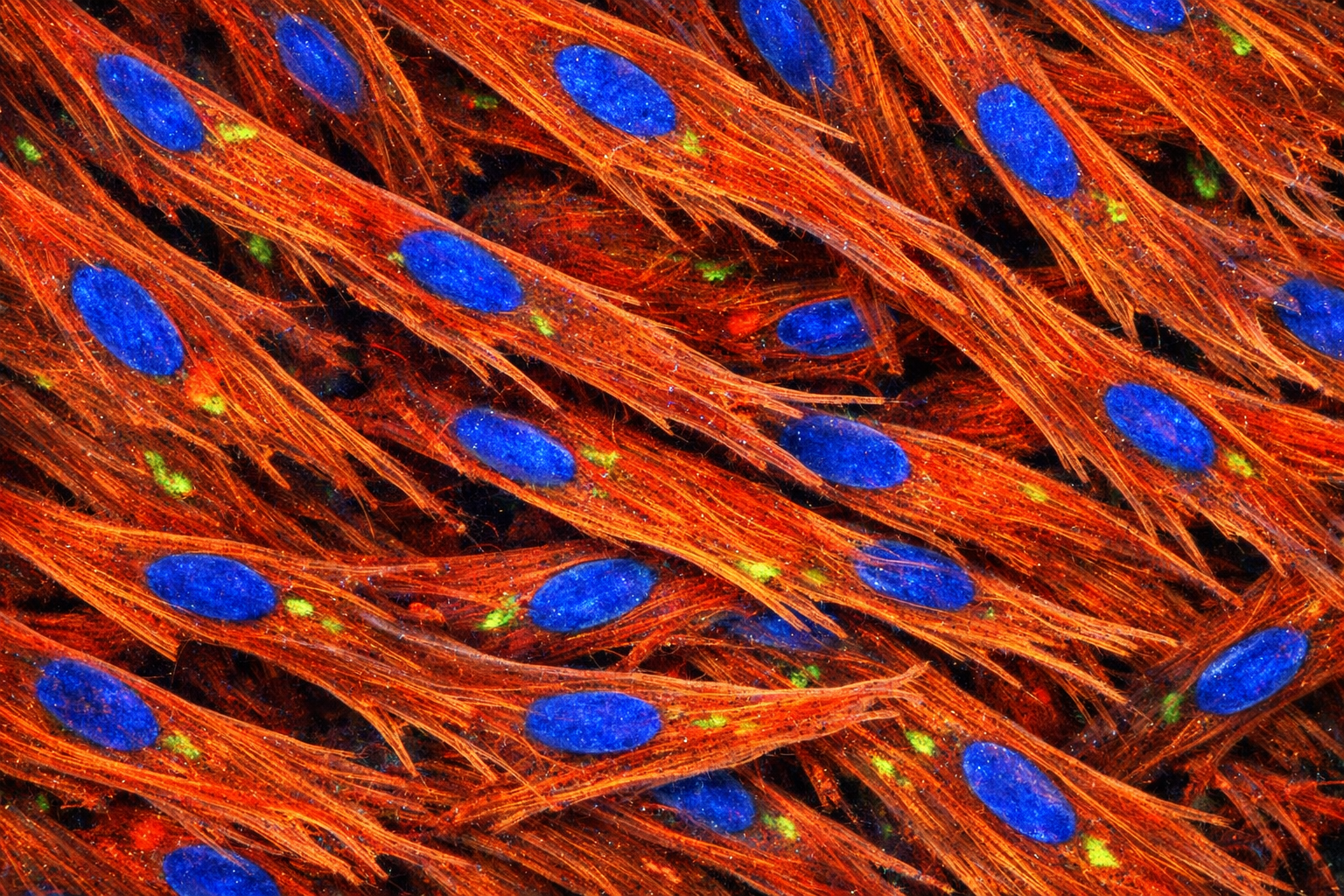 Human Primary Diabetic Liver Vein Smooth Muscle Cells