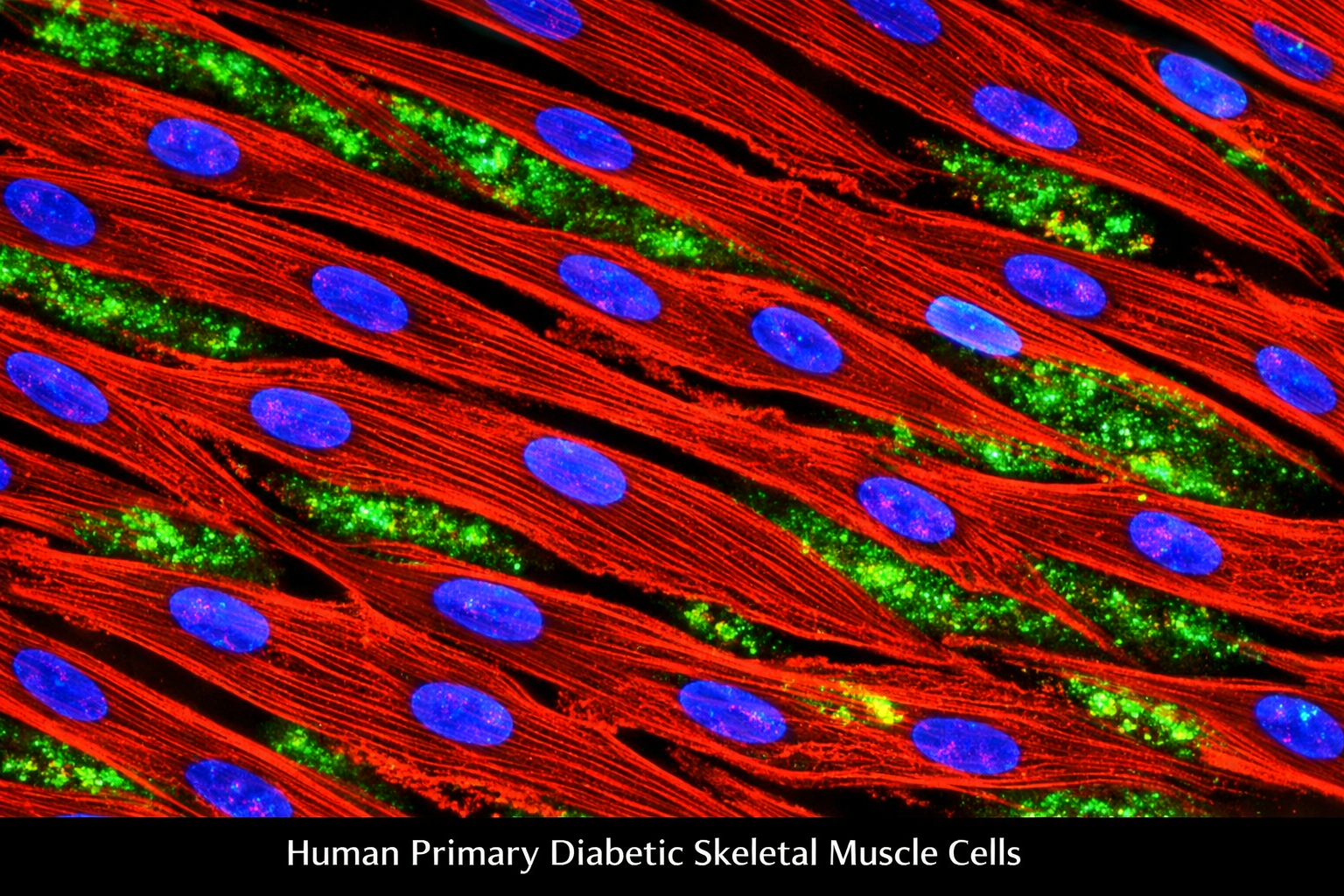 Human Primary Diabetic Skeletal Muscle Cells