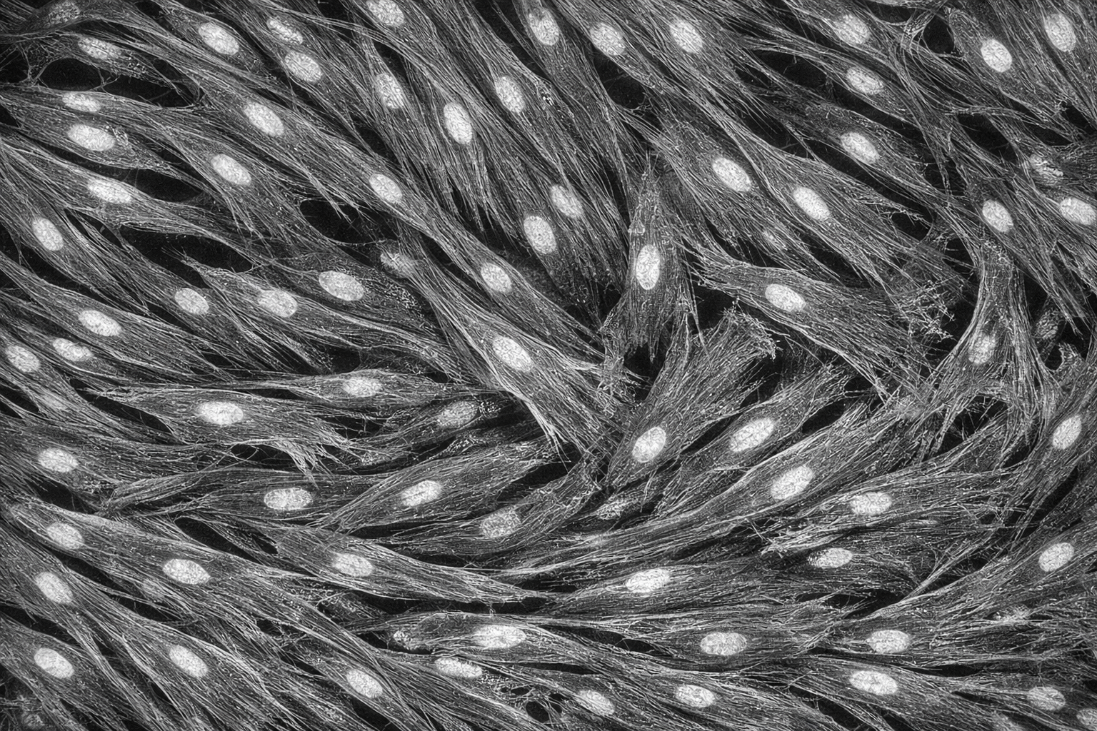 Human Primary Diabetic Tracheal Smooth Muscle Cells