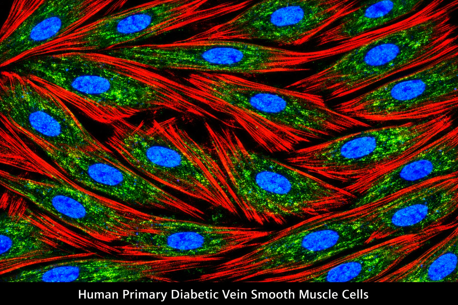 Human Primary Diabetic Vein Smooth Muscle Cells
