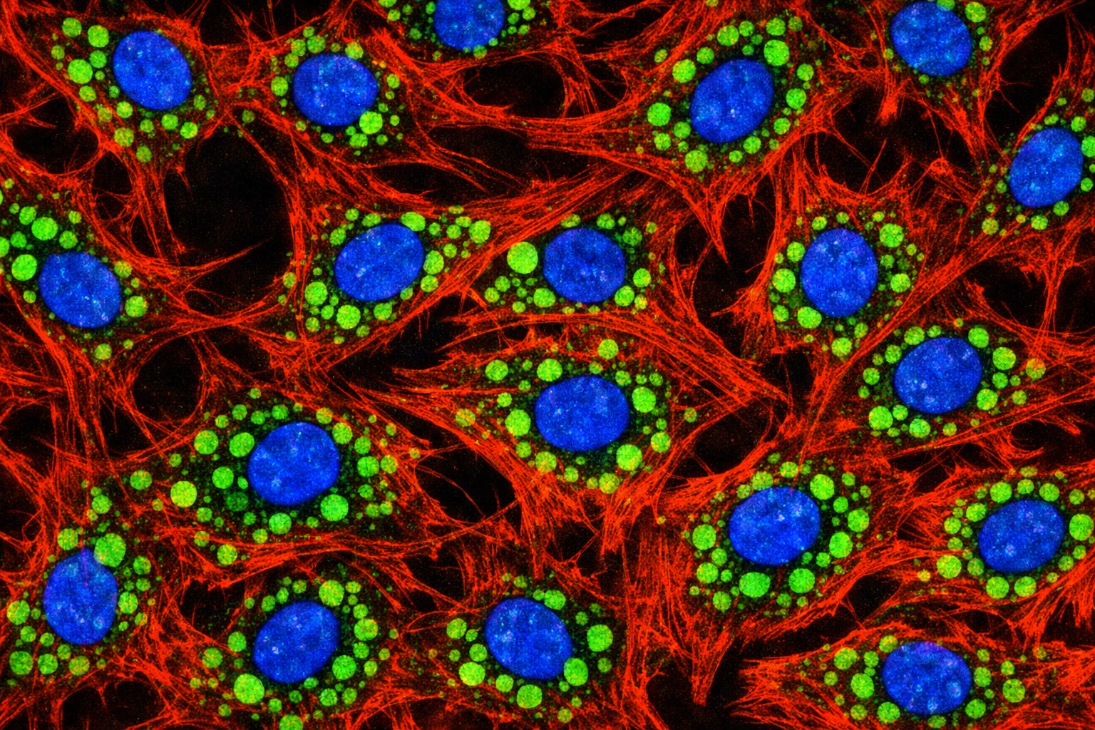 Human Primary Diabetic Alveolar Epithelial