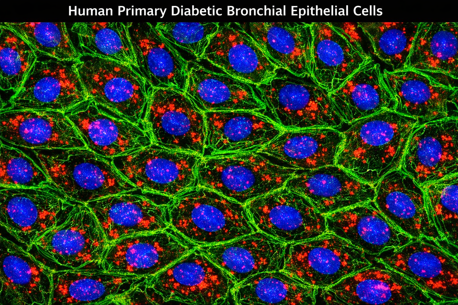 Human Primary Diabetic Bronchial Epithelial Cells