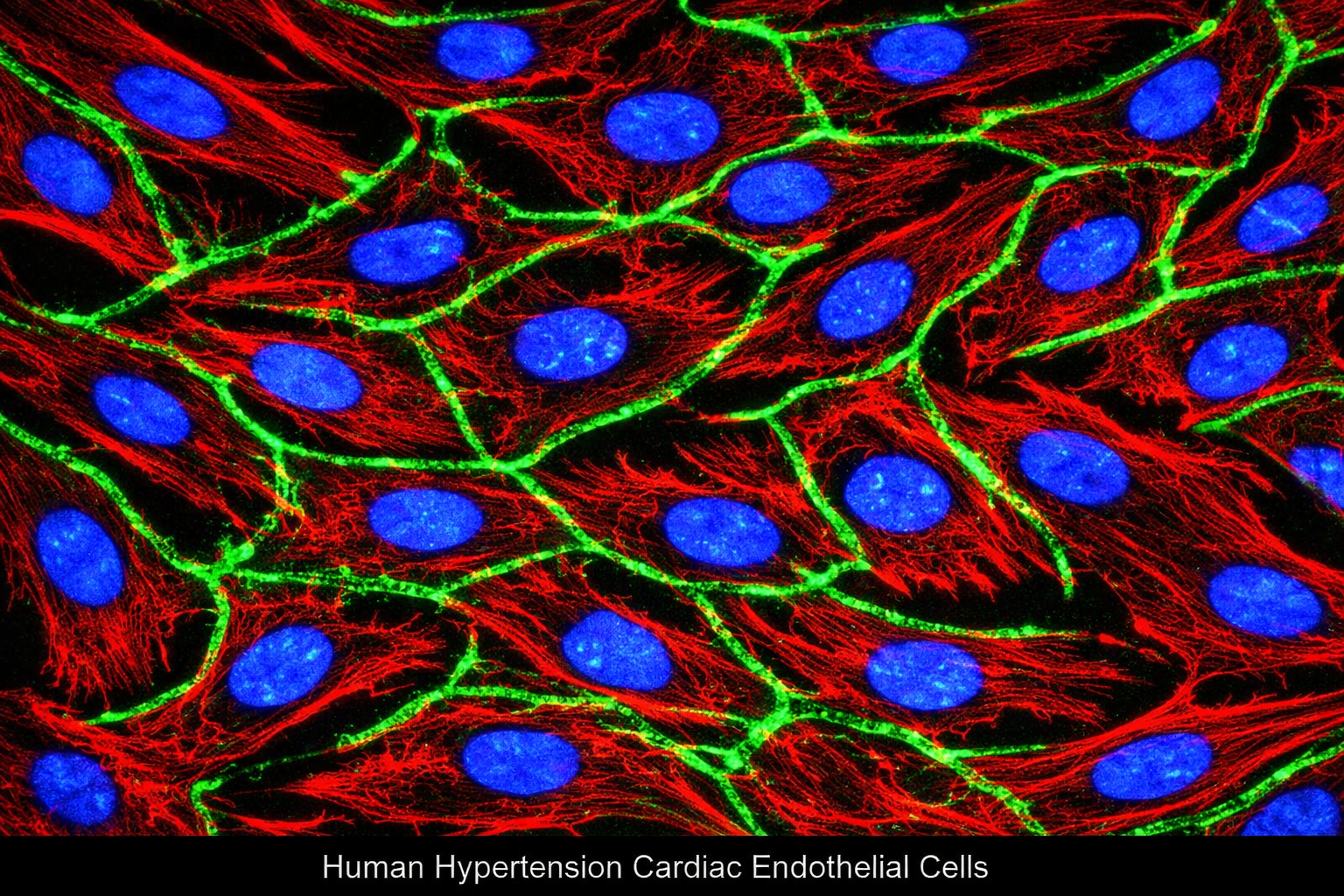 Human Hypertension Cardiac Endothelial Cells