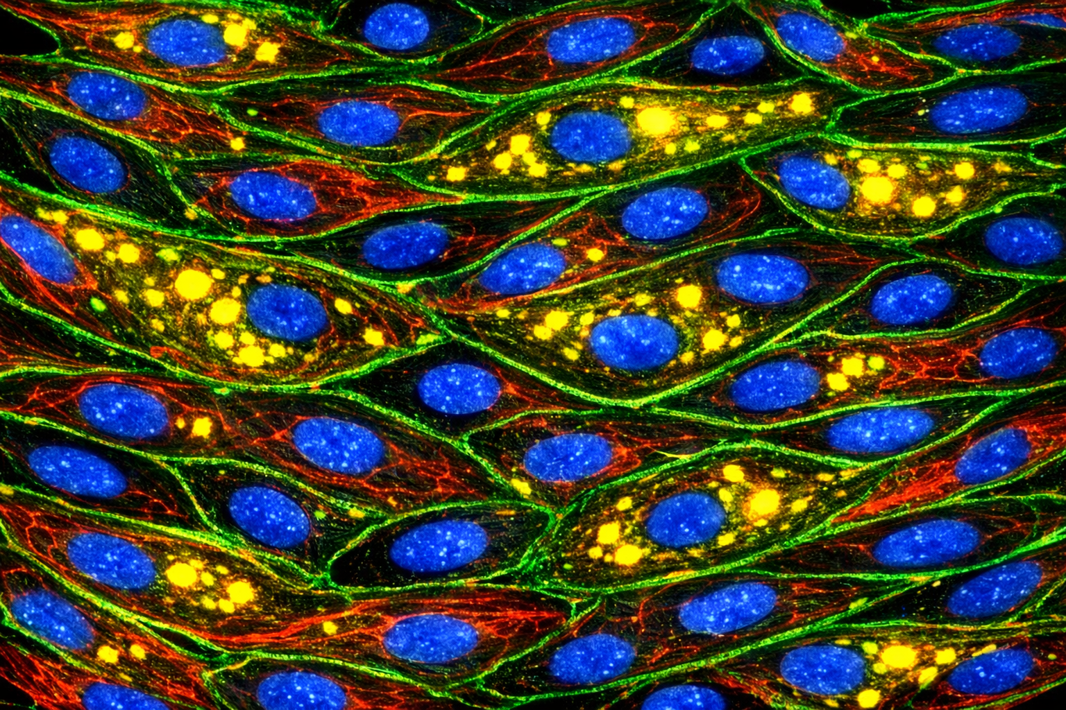 Human Hypertension Coronary Artery Endothelial Cells