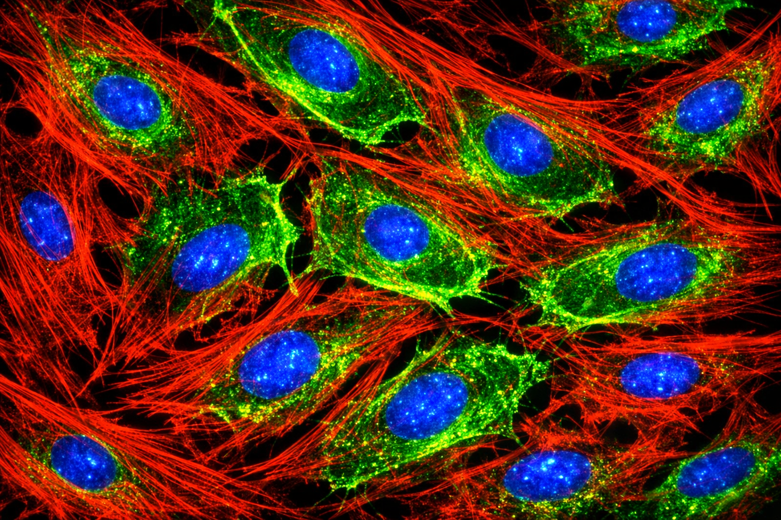 Human Hypertension Kidney Endothelial Cells