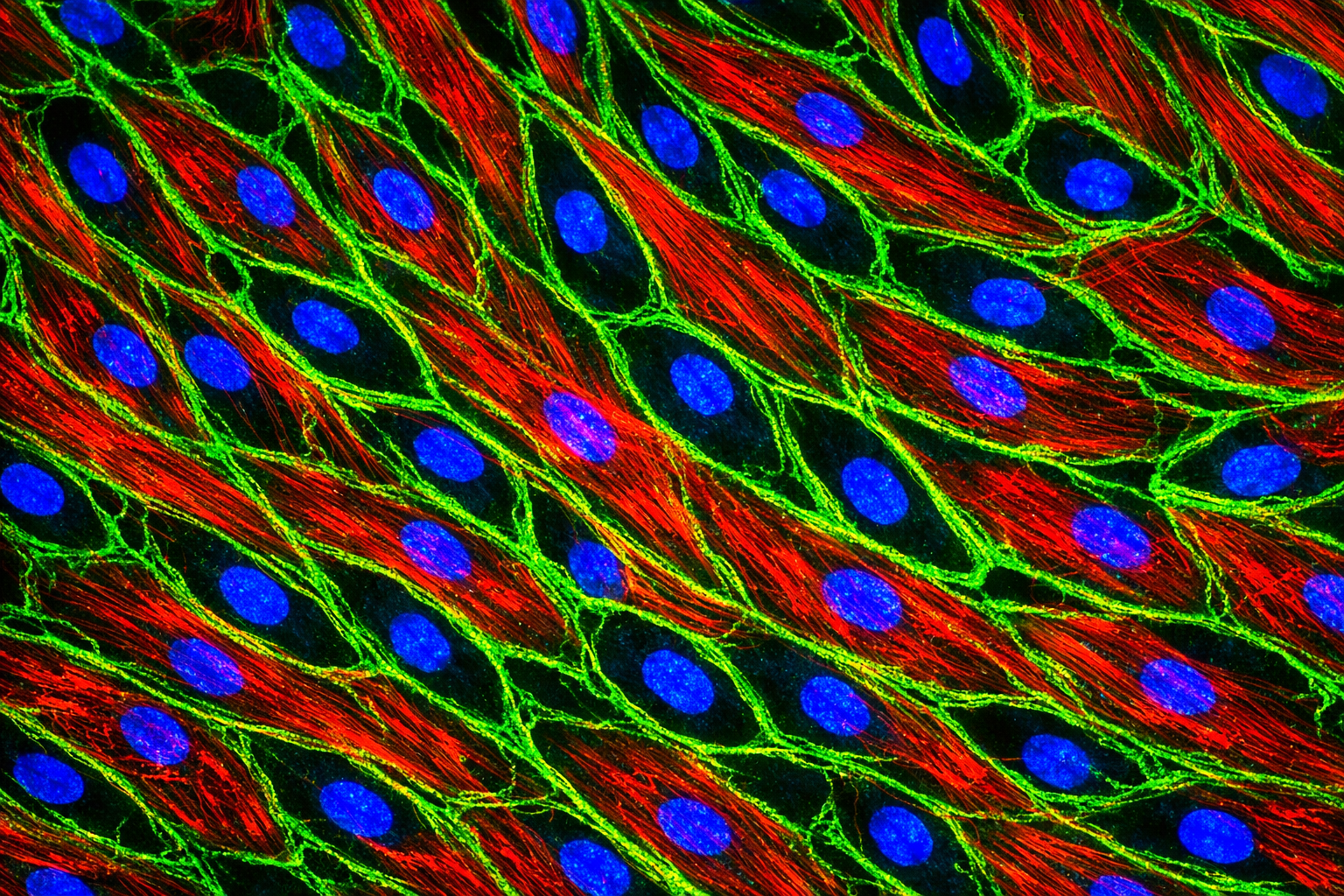 Human Hypertension Lung Endothelial Cells