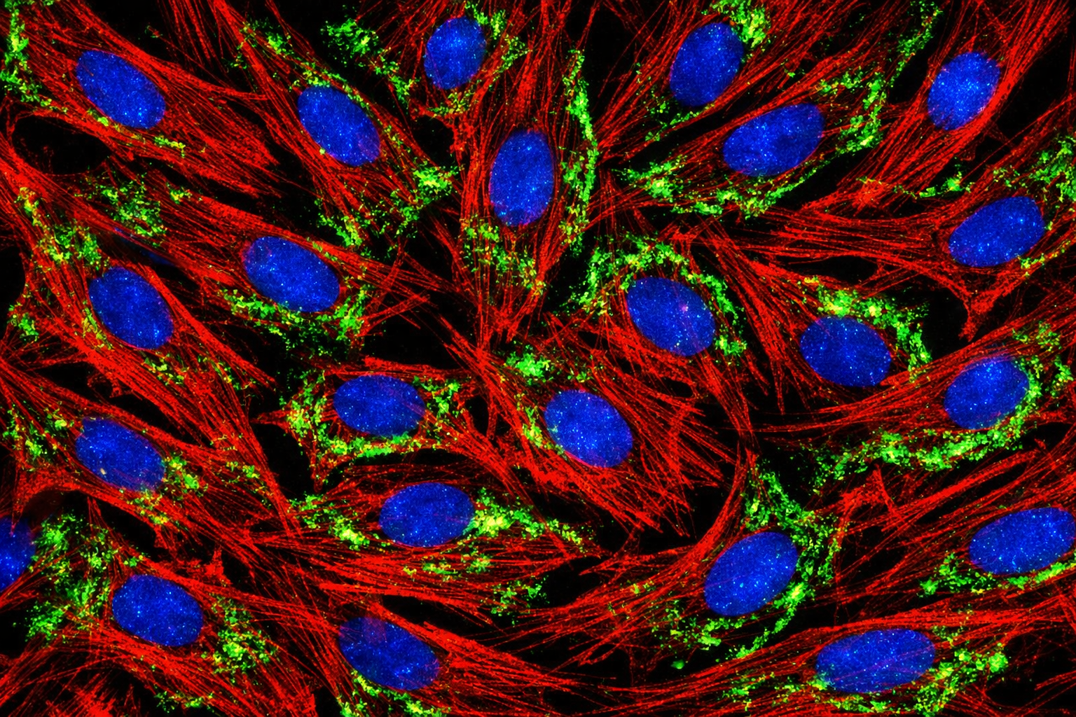 Human Hypertension Pulmonary Artery Endothelial Cells