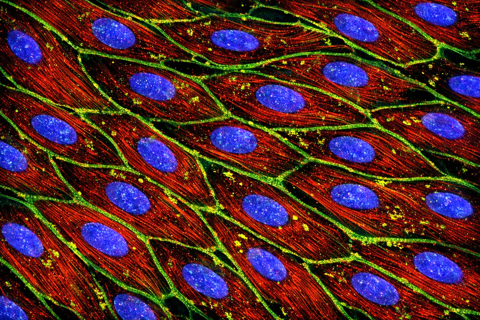 Human Hypertension Vein Endothelial Cells