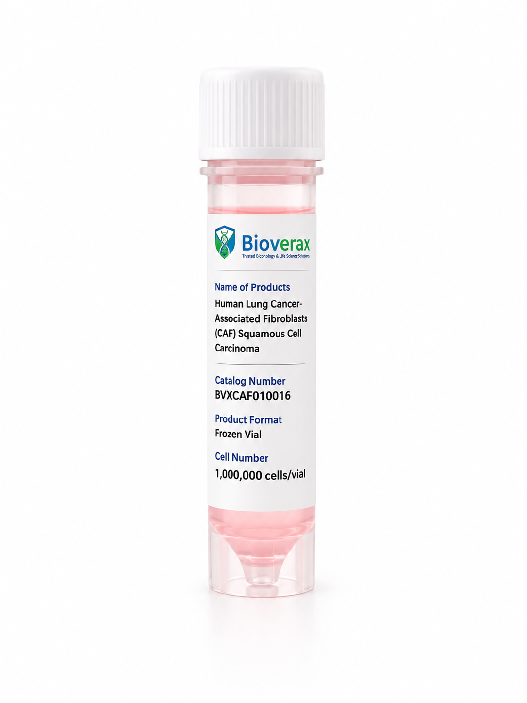 Human Lung Cancer-Associated Fibroblasts (CAF) Squamous Cell Carcinoma